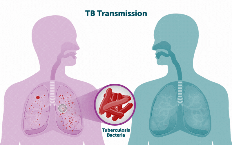 TB Transmission.gif