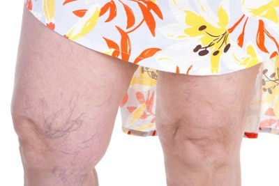 Finir avec les jambes lourdes grace au maitre marabout FAGLA