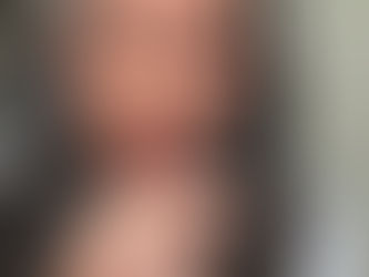 Lumbalgia, vértigo y Rosario