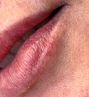 Veins after_edited.jpg