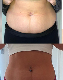 Before and after pictures.JPEG