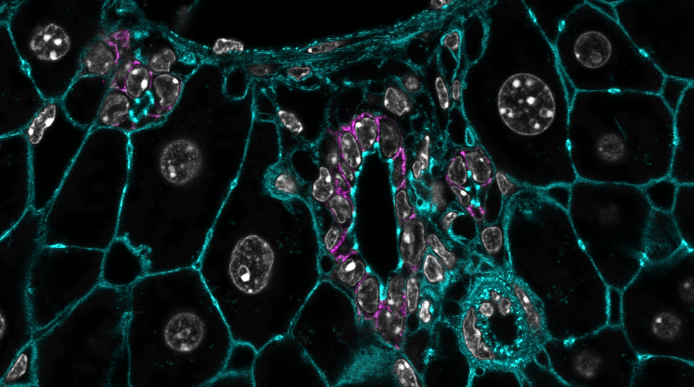 20230329_Periphery_and_embryonic_EpCam_AcTub_DAPI_Phal.lif - Periphery_many_bile_ducts-1-s