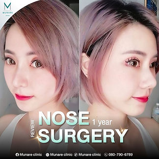 รีวิวจมูก_eng-02.jpg