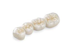 Bridge dentaire zircone