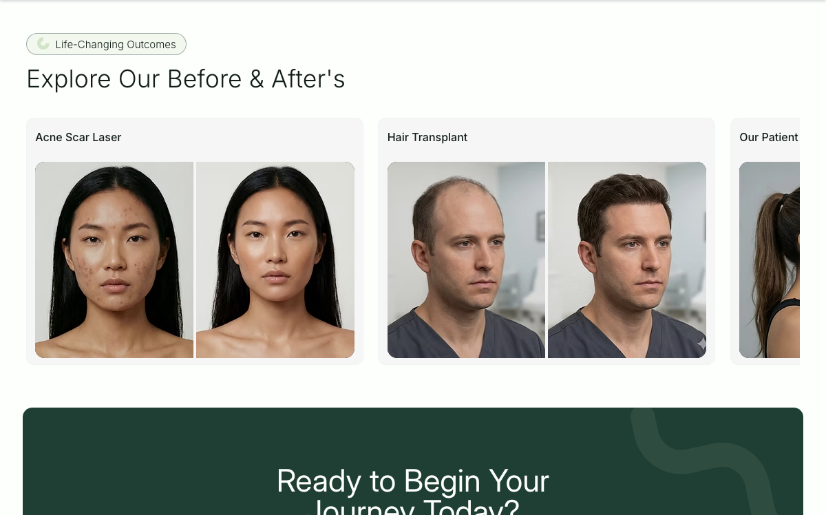 Before & After's