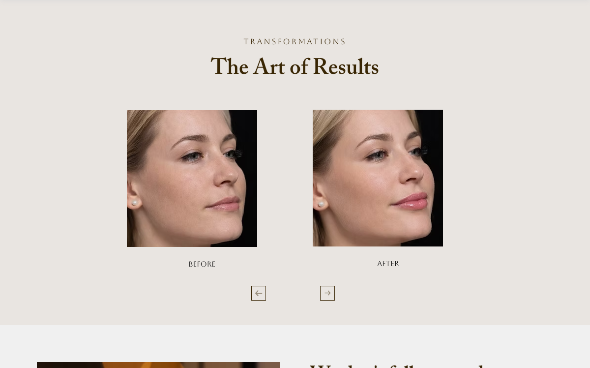TRANSFORMATIONS
