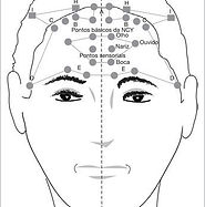 Yamamoto new scalp acupuncture_ its applications and results in painful conditions_ System