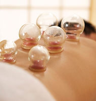 Have you tried #Cupping yet_ It's a form of….jpg