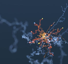 ibm-ai-alzheimers-disease-cure-machine-l