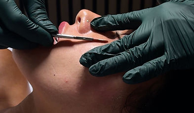 Dermaplaning Facial being performed at Flirt Beauty Bar in Temecula