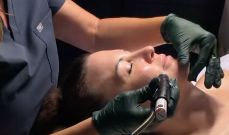 Client receiving HydraFacial treatment in Temecula at Flirt Beauty Bar