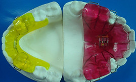 twin-block-appliance-orthodontic-laborat