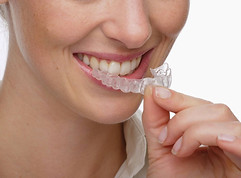invisalign.jpg