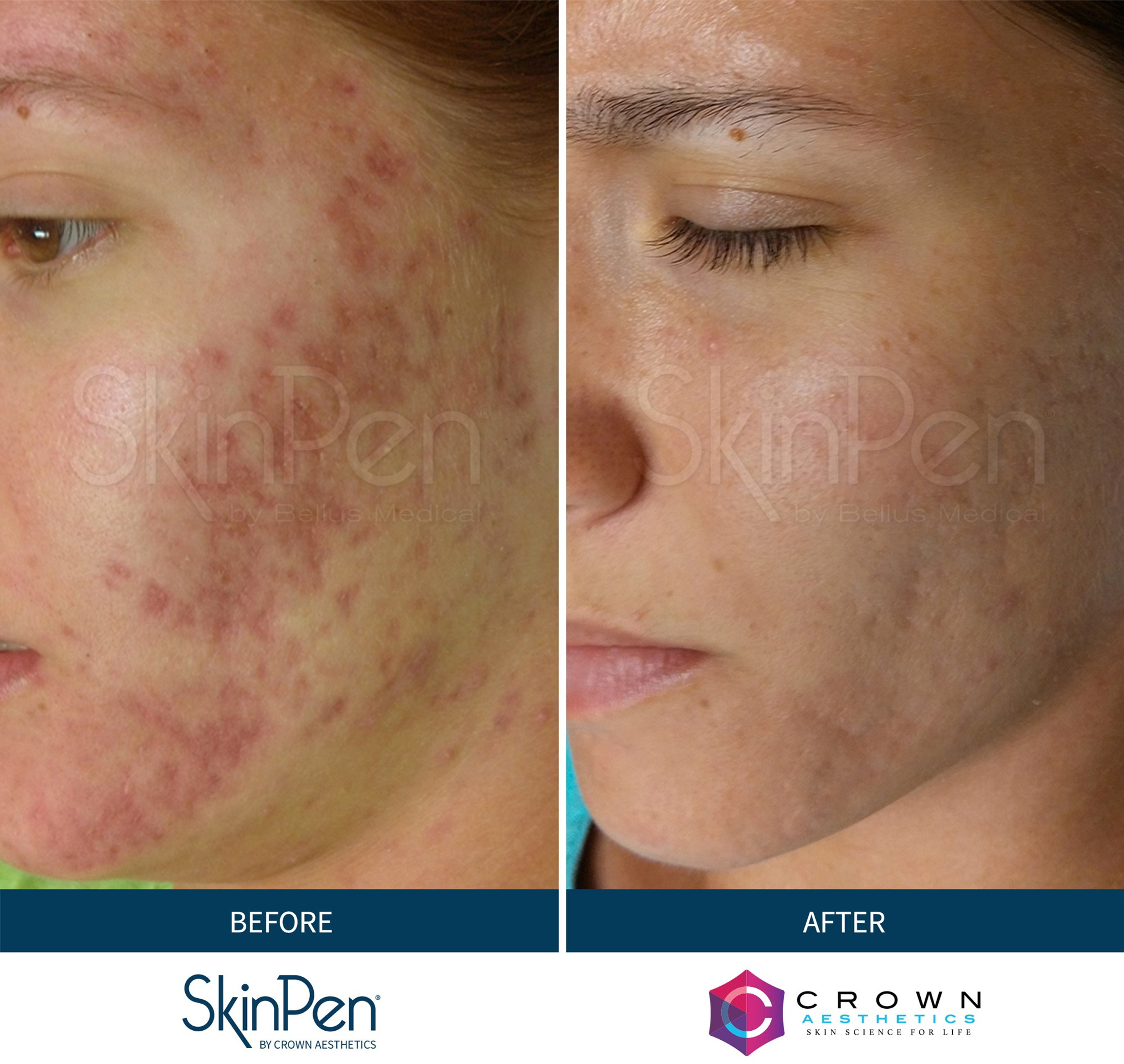 Clean Slate Med Spa Reno, NV