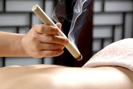 艾灸 Moxibustion TCM