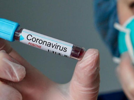 Rio confirma terceira morte pelo novo coronavírus