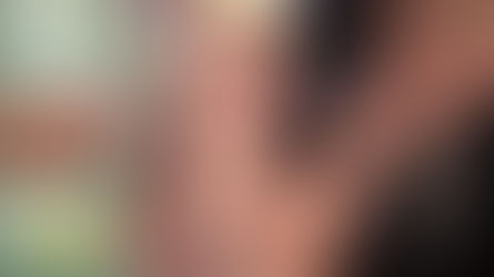 Saúde confirma 930 casos de sarampo no Paraná