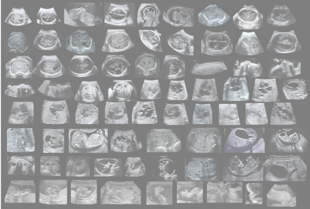 100 AC - Imagen Banner.png