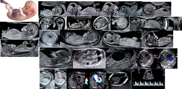 Early Fetal Medicine - Banner.png