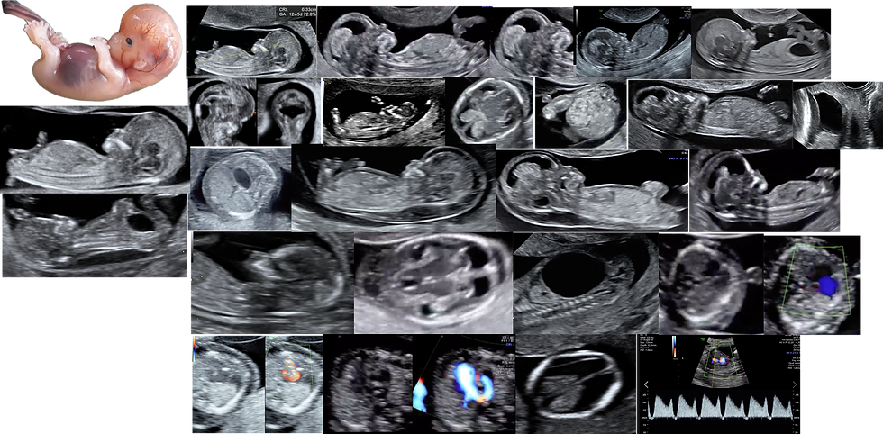 Early Fetal Medicine - Banner.png