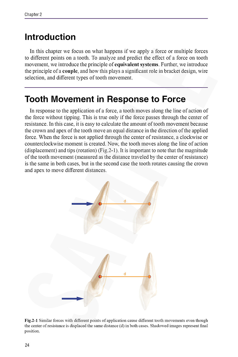 Mechanotherapy in Orthodontics Vol.1 Basic Biomechanics ctoracademy