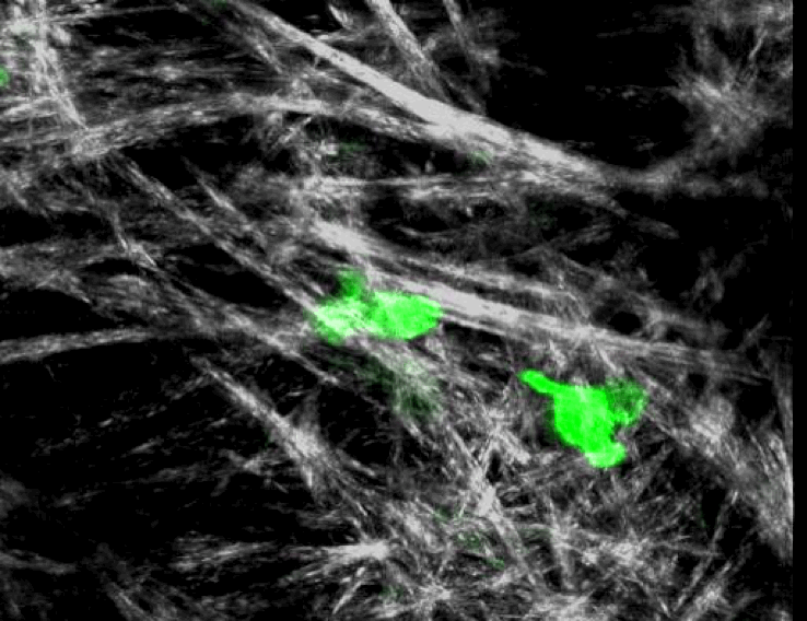 CD4 T Cell Motility in Inflamed Tissues