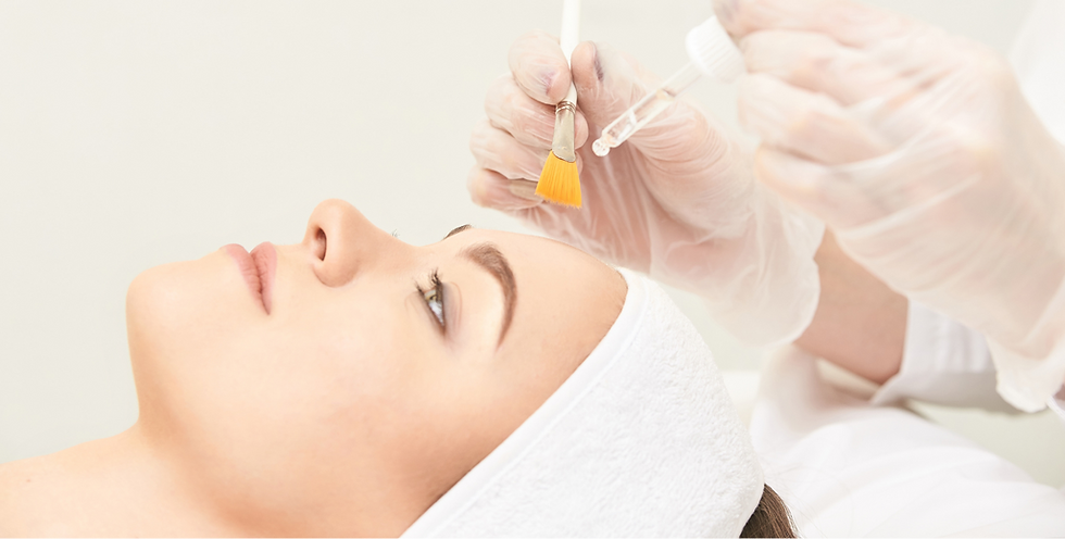 chemical peel beautyland.png