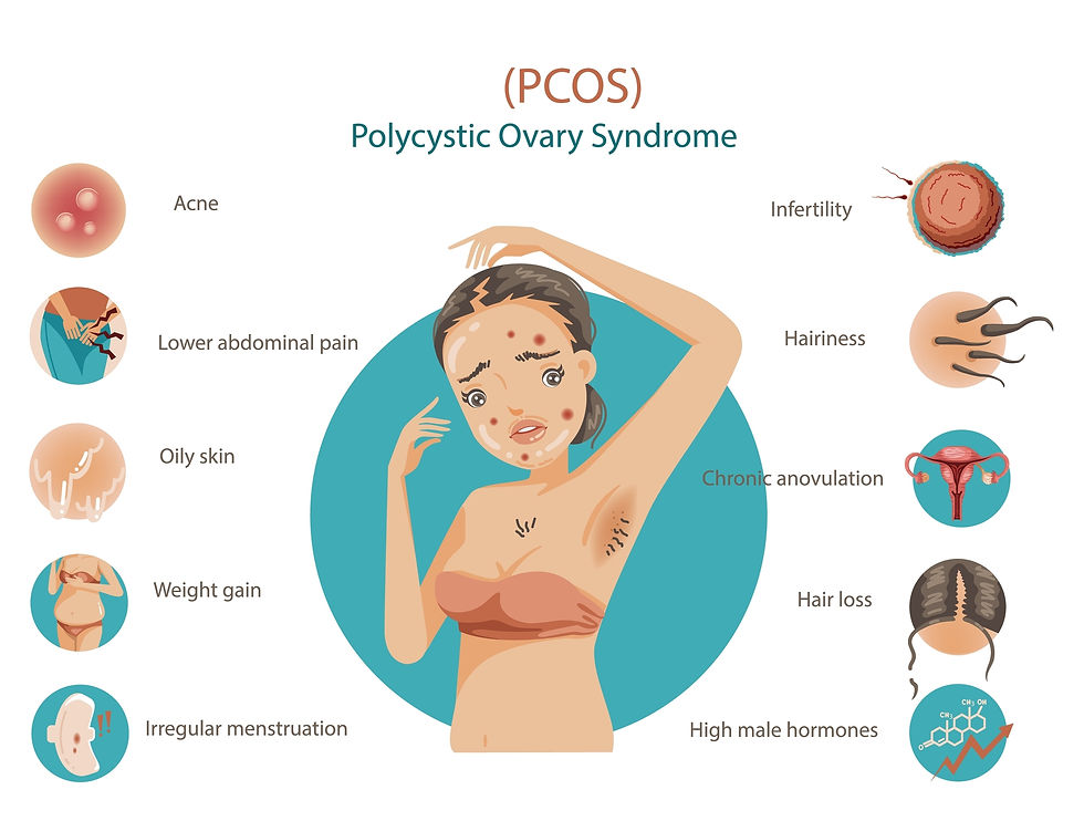 PCOS symptoms graphic showing acne, weight gain, irregular menstruation, infertility, hair loss, excess hair growth, oily skin, and high male hormone levels.