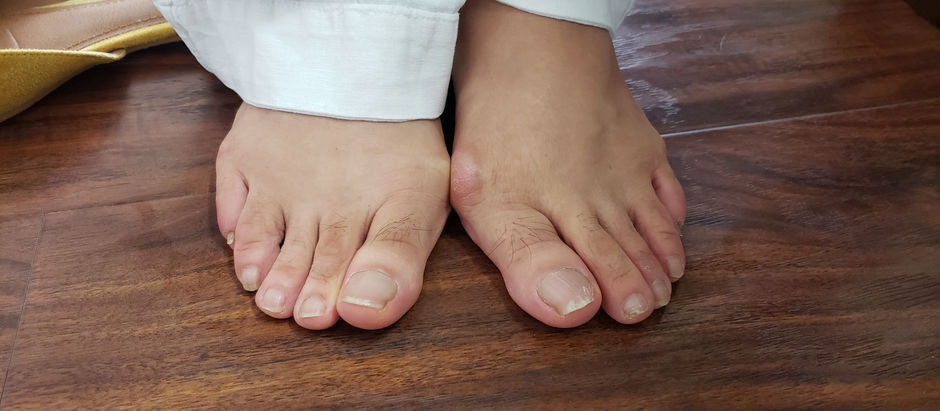 52. 심장마비, 뇌졸중 등 돌연사는 발이 좋아야 예방 된다   