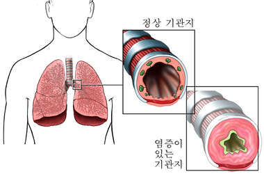 115. 왜 노인들이 코로나에 속수무책으로 당하나?