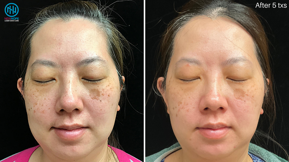 Angel PICO front 5 txs.png