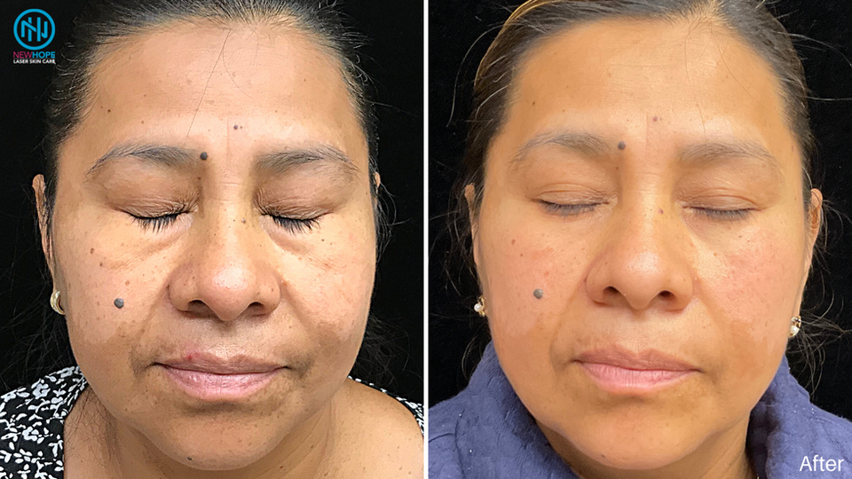 Maria Z front PICO Genesis.png