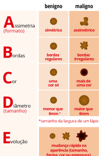 cancer-de-pele.png