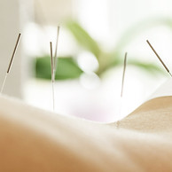 Acupuncture