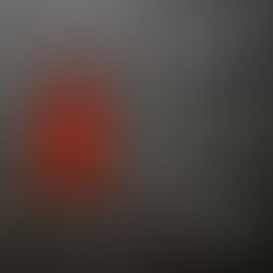 Blood cancers linked to HIV: Insights from recent studies ~ Dr. Antonio Giordano (Sbarro Institute)