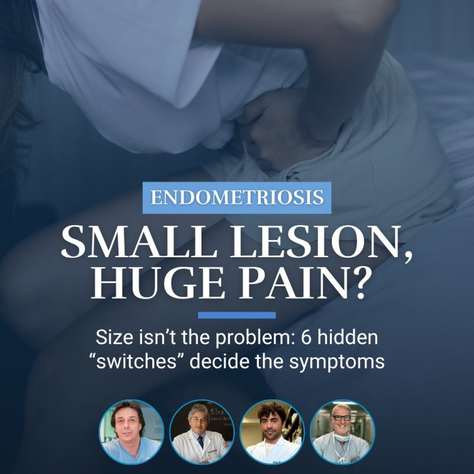 Endometriosis Not Only One Disease: Research Maps Six Cancer-Like “Switches” Shaping Each Woman’s Symptoms