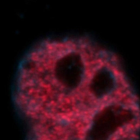 Tumori, scoperta la proteina guardiano del DNA: perché ha una preziosa funzione anti cancro