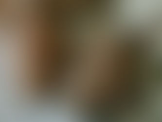 The Enigma of “Early-Onset” Cancers: why are youthful Tumors on the rise?