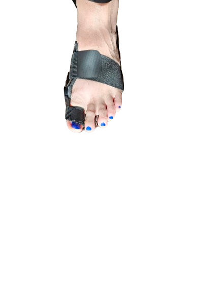 Thumbnail: Bunion corrector toe separator left foot top view
