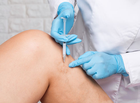 escleroterapia.jpg