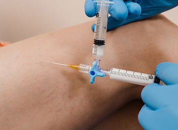 escleroterapia com espuma.jpg