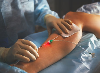 cirurgia e termoablação2.jpg