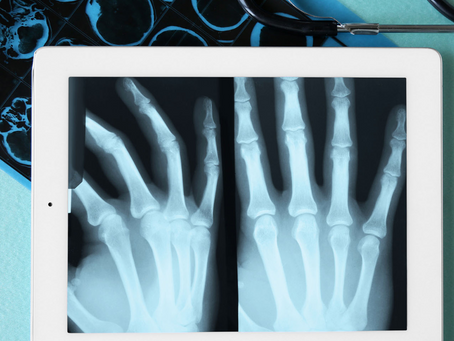 Benefits of Mobile X-ray at Correctional Facilities