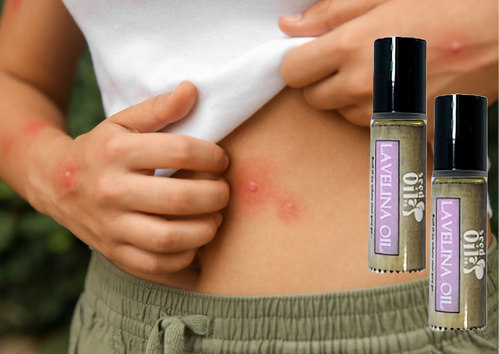 camelina and lavender help bug bites