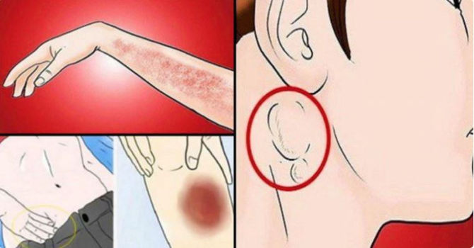 25 Cancer Signs People Ignore Until It’s Too Late: