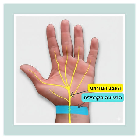 איור במתאר את כף היד, את התעלה הקרפלית ואת העצב המדיאני שעובר בתוכה