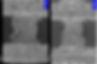 titanium before and after.jpg
