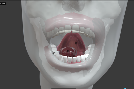 Tongue of dental project