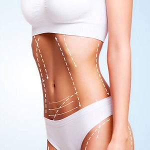 lipo_edited.jpg