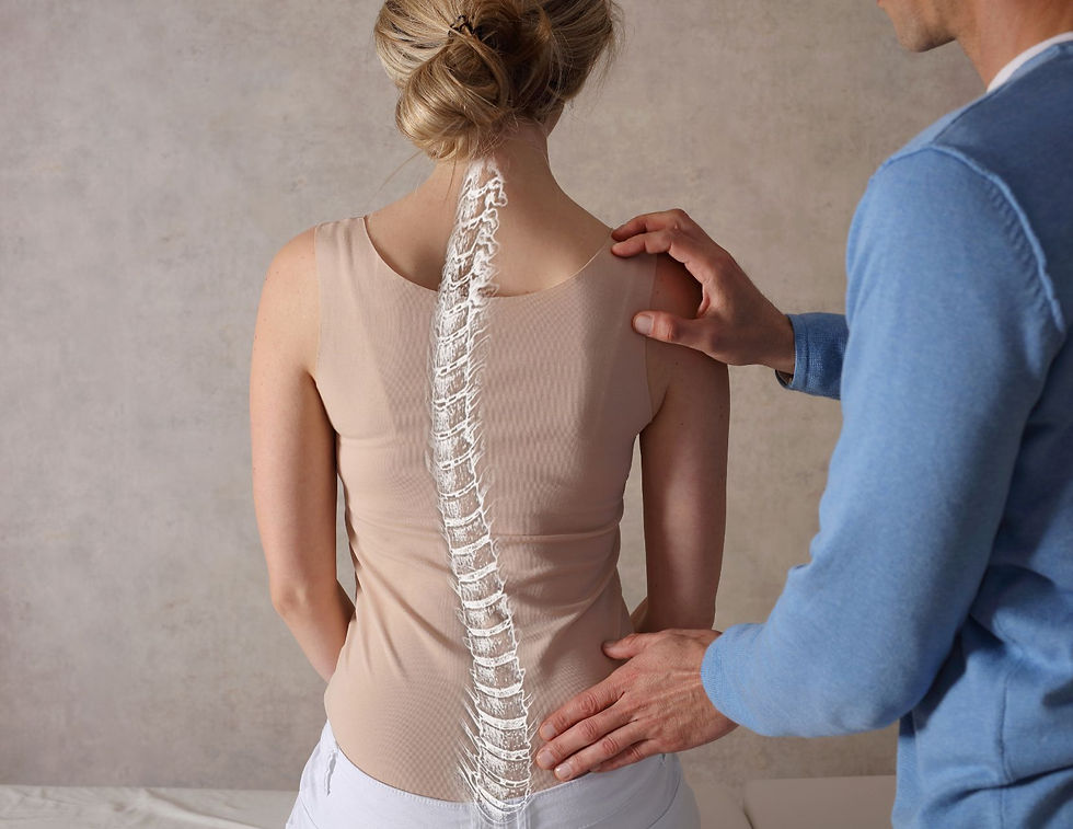 Misaligned Spinal Column